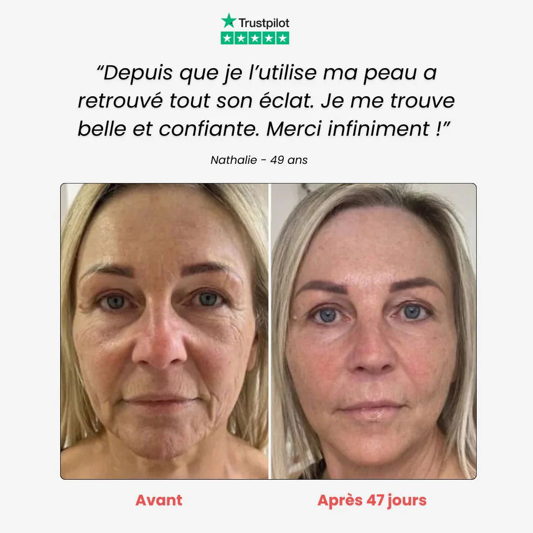 LuminSkin - Masseur Facial LED