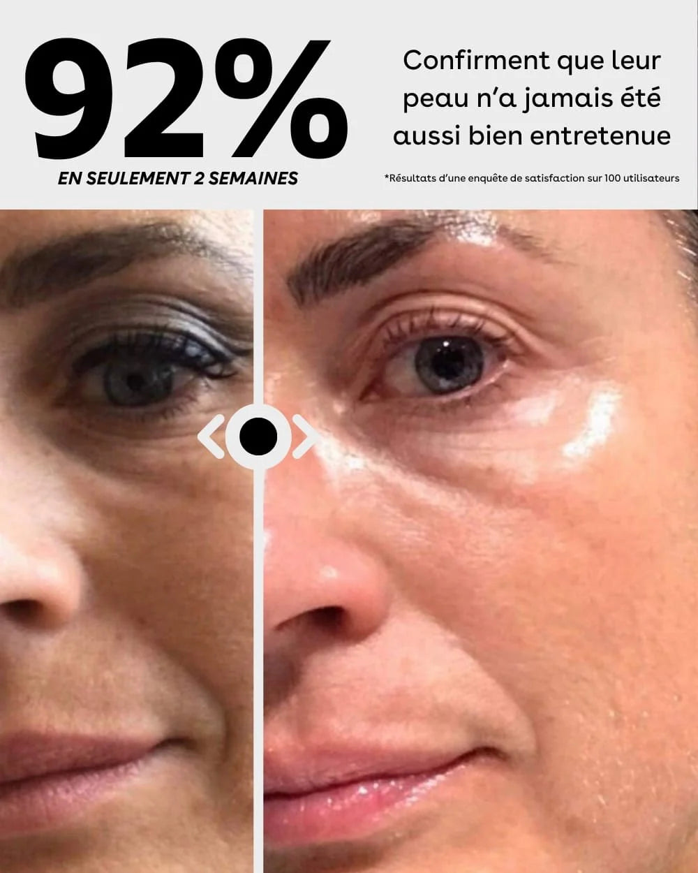 SkinLed - Masque LED pour une peau éclatante